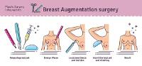 Breast Enlargement London image 3